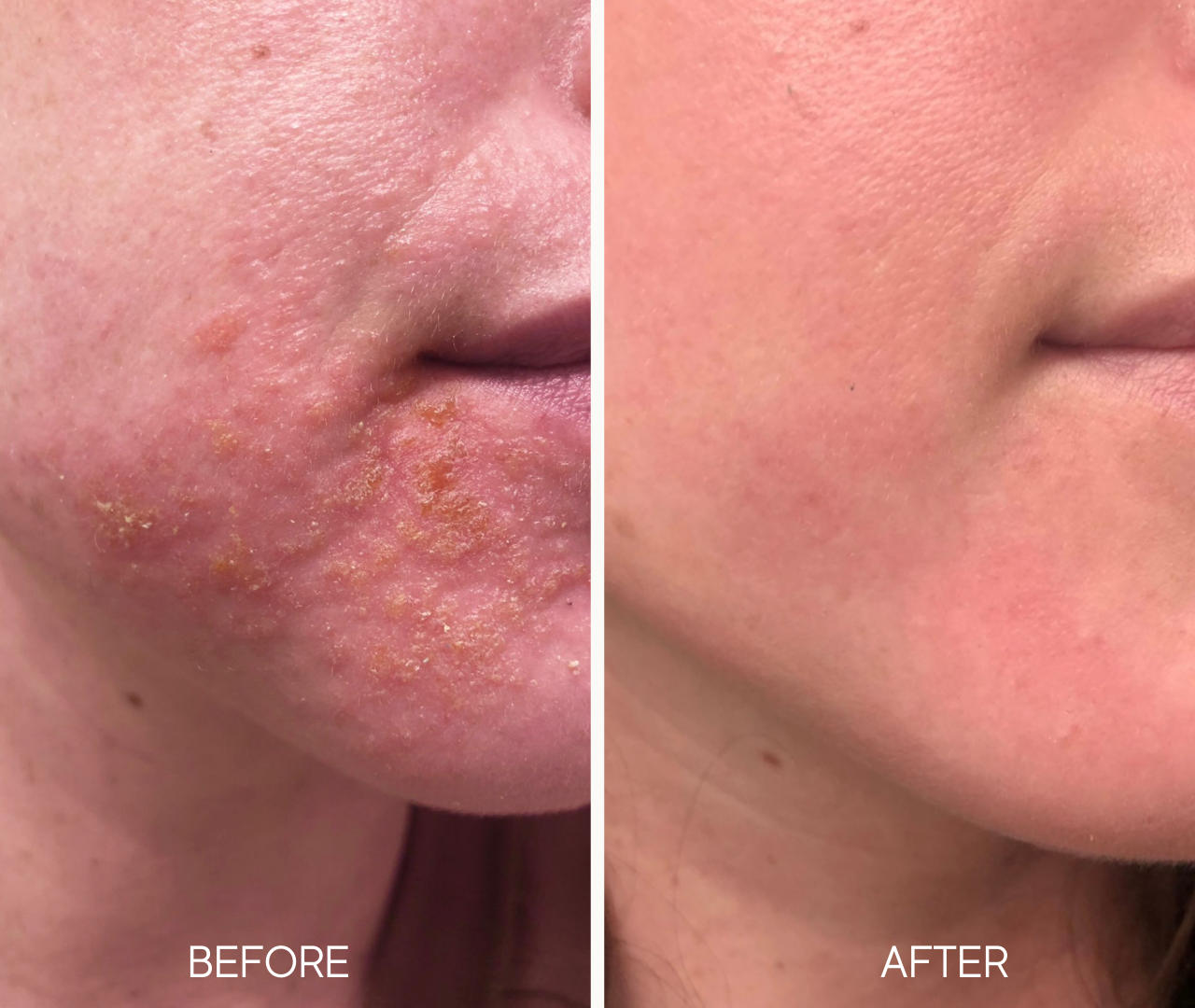 Lumielle Glass Skin Liquid Exfoliant - Image 4