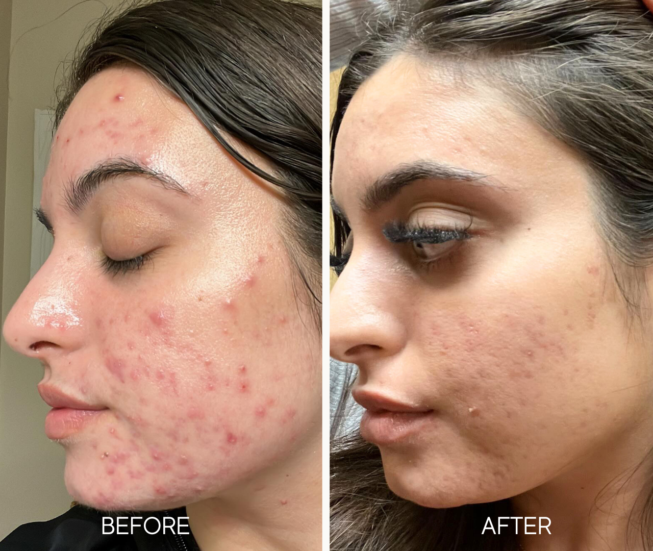 Lumielle Glass Skin Liquid Exfoliant - Image 2