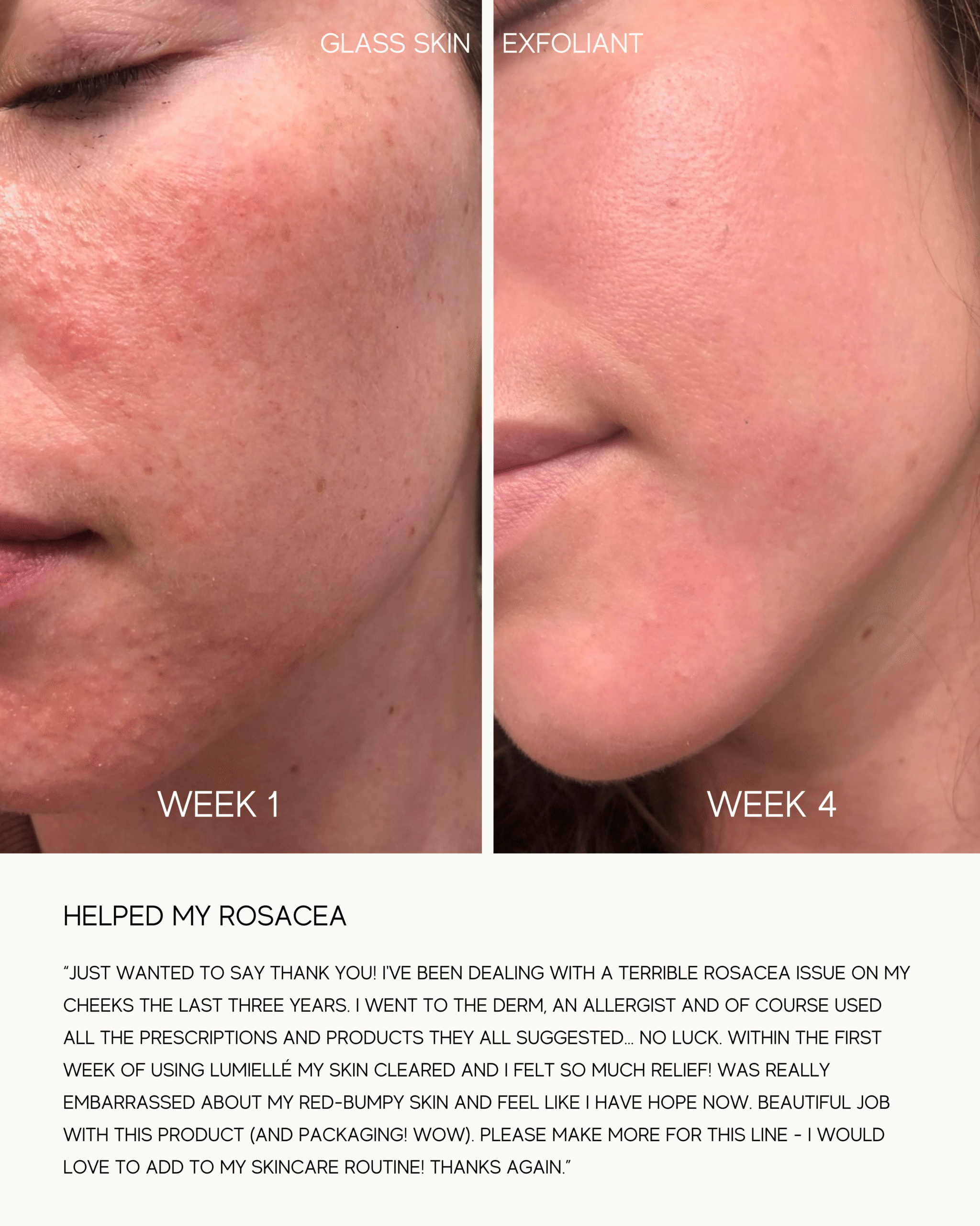 Lumielle Glass Skin Liquid Exfoliant - Image 3